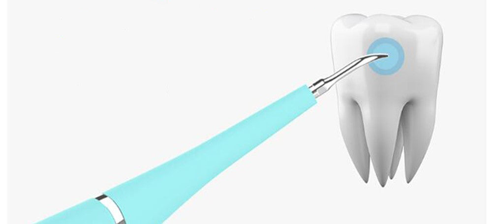 Dentalcare™ Ultraschallreiniger | Strahlend saubere und gesunde Zähne!